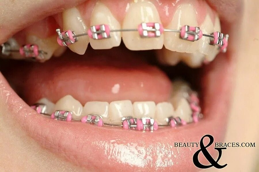 Brackets 2025. Brackets 2025