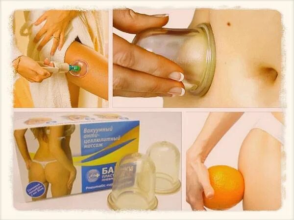 Вакуумный антицеллюлитный массаж. Вакуумный массаж банками. Баночный массаж хиджама. Как правильно пользоваться вакуумными банками. Массажные вакуумные банки.