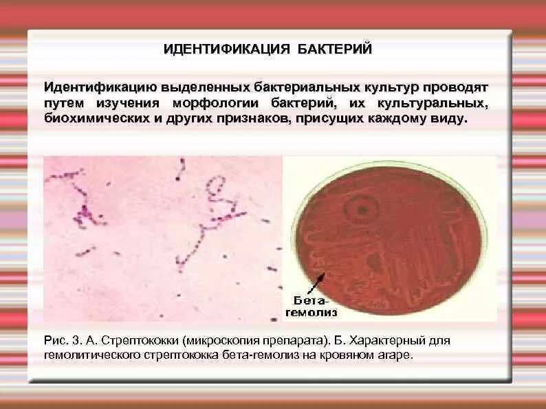 Классификация микроорганизмов. Идентификация бактерий по морфологическим свойствам. Биохимические методы исследования микроорганизмов. Методы идентификации бактерий. Признаки классификации микроорганизмов.