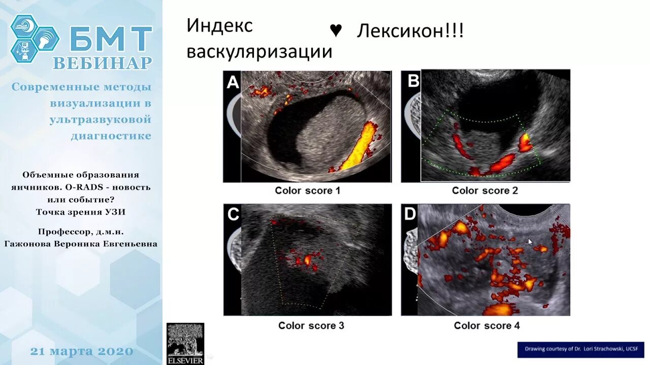 Киста яичника orads. РАДС классификация образований яичников. Классификация o-rads для УЗИ. Классификация опухолей яичников orads. O rads классификация яичников.