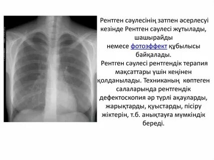 Дагестандық жаңа порно