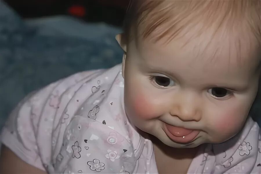 Постоянно высунутый язык. Речёнок показывает язык. Женщина с высунутым языком. Девушка с вісунутім язіком. Макроглоссия у новорожденных.