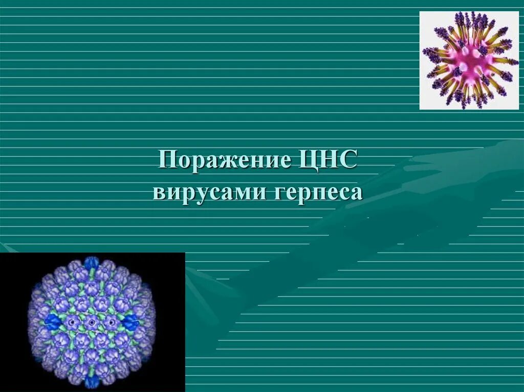 System virus. Вирусы поражающие нервную систему. Вирус герпеса поражающий ЦНС.