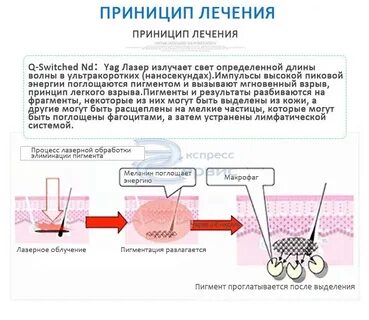 Какой лазер удаляет