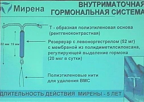 Введение внутриматочной спирали Мирена. Гормональная спираль Мирена. Мирена внутриматочная терапевтическая система. Внутриматочная гормональная спираль Мирена. Крови после установки спирали мирена