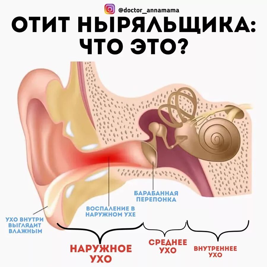 Наружный и внутренний отит.