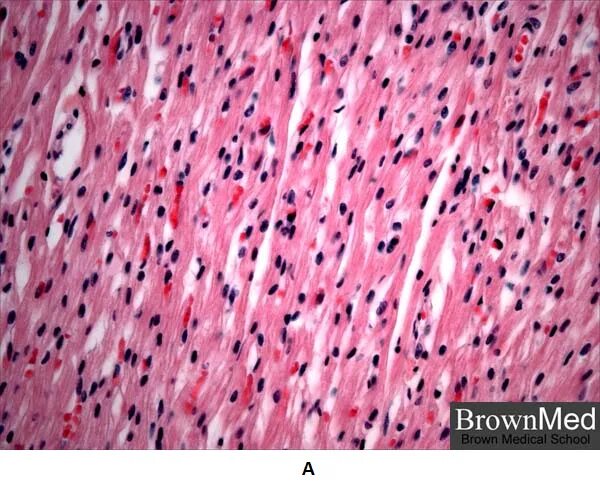 Сердечная ткань миокарда. Секреторные клетки миокарда. строение клеток миокарда. клетки миокарда многоядерные. клетки миокарда состоят из.