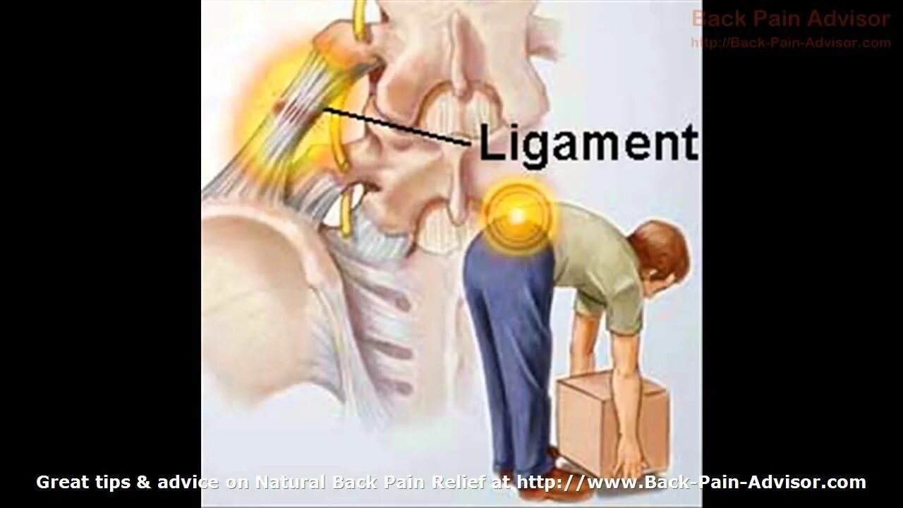 Что делать если сорвал спину. Связки спины.