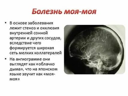 Болезней она не