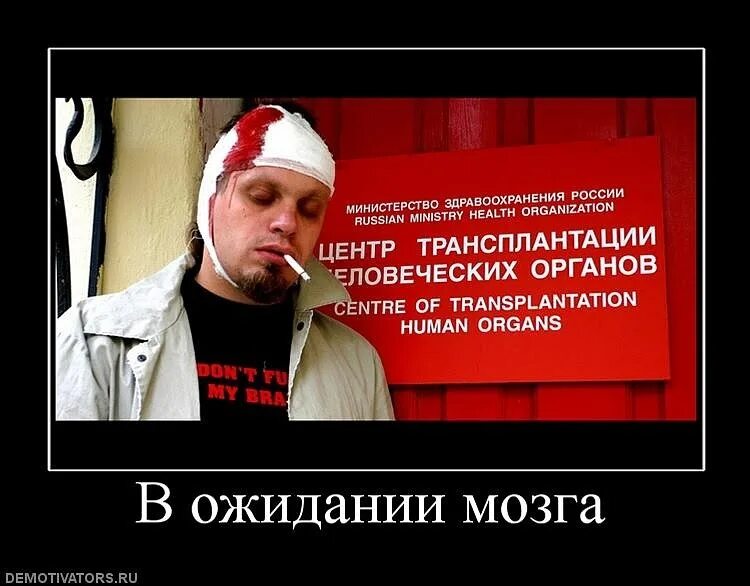 Нет мозгов. Мозг дебилов. Мозг дебилов. Мозг дельфина и мозг человека. Мозг хохла.