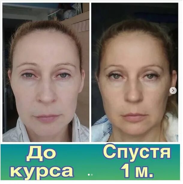 Мьюнинг до и после