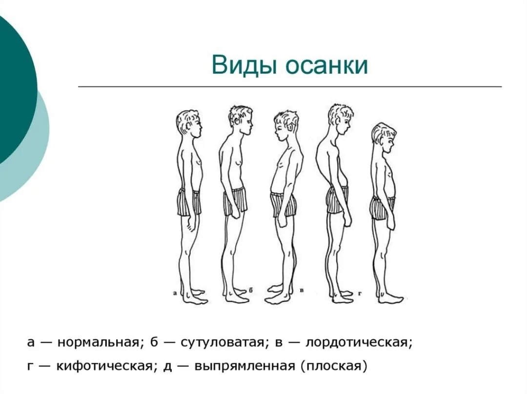 Как называется нормальный человек. Типы осанки человека и названия. типы нарушения осанки человека. какой тип осанки считается нормальным?. виды неправильной осанки.