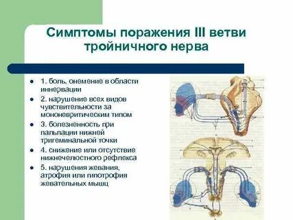 Поражение тройничного нерва