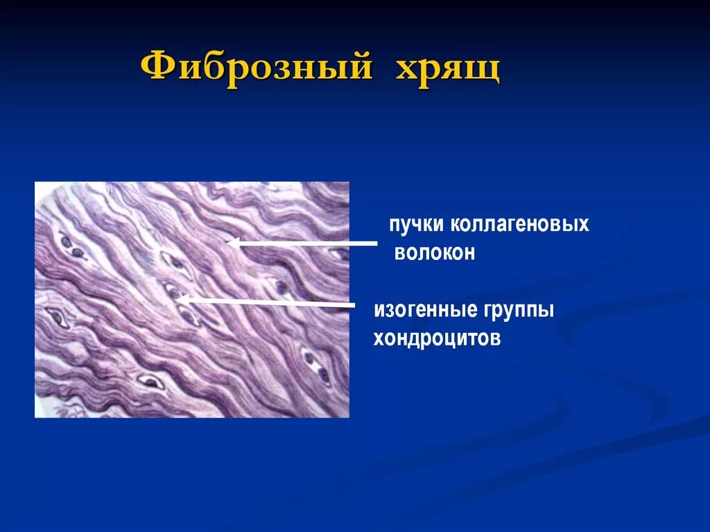 Изогенные группы. Фиброзная соединительная ткань. Волокнистый хрящ соединительная ткань. Фиброзная хрящевая ткань. Волокнистая хрящевая ткань пучки коллагеновых волокон.