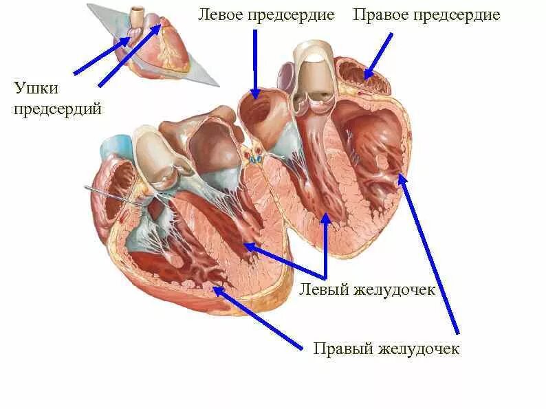 Тромб в желудочке