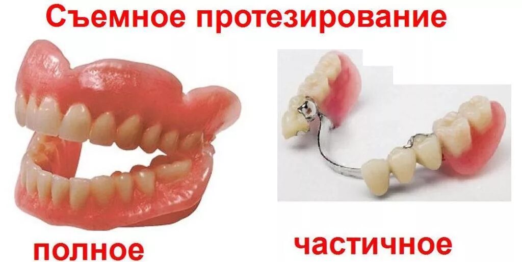 Ремонт зубных протезов в москве срочный съемных