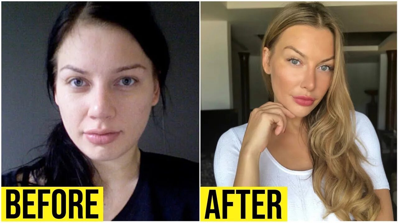 My before. Anna bey before after. school of affluence anna. anna taylor joy before plastic surgery and after. 5g before after.
