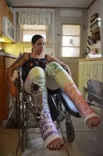 She broke has broken her leg