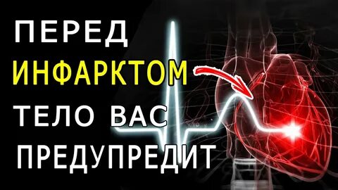 Сердечный перед