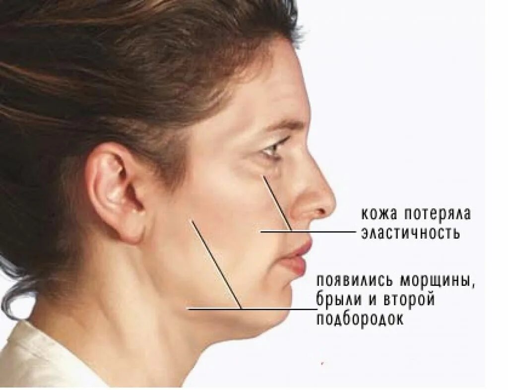 Потерять лицо. Потеря эластичности кожи. Кожа потеряла эластичность. Мышцы подбородка брыли.