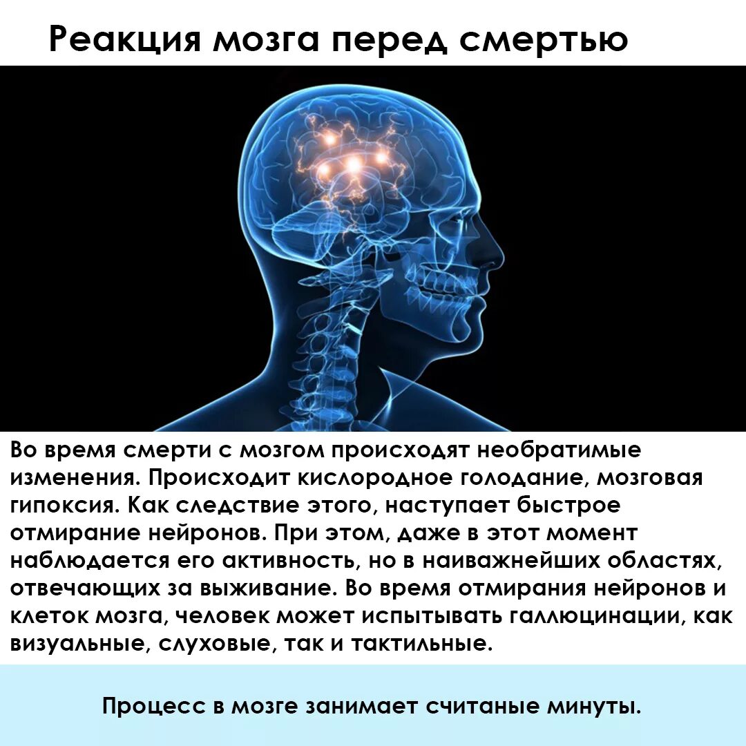 Необратимые изменения мозга. Мозг человека после смерти.