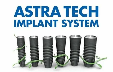 Astra tech импланты отзывы