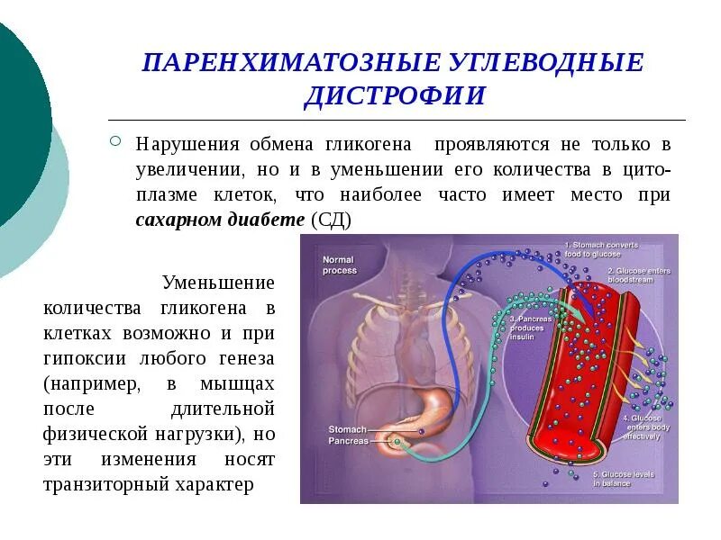 Паренхиматозные углеводные дистрофии. Углеводные дистрофии патанатомия. Паренхиматозные углевоы. Углеводы паренхиматозной дистрофии.