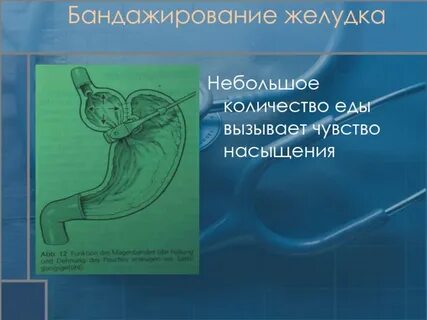 Быстро желудок