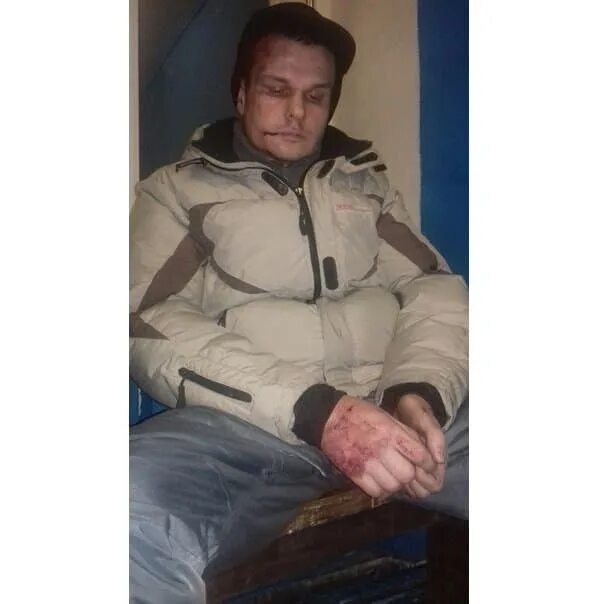 Нашелся человек без документов. Мужчины потерявшие память. Найден человек потерявший память. Найден человек потерявший память. Человек без памяти.