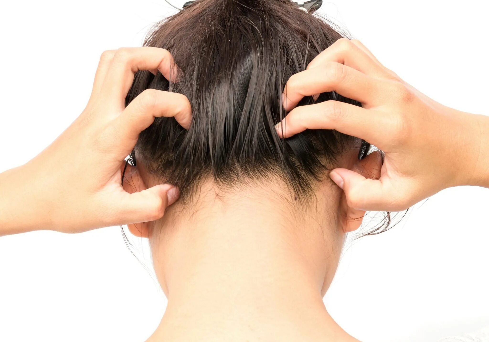 Чешется затылок. Псориаз на шоллае. Дерматозы волосистой части головы. Почесывание затылка. Чесание головы.