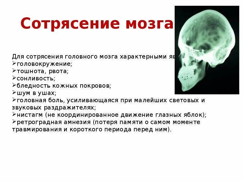 Последствия сотрясения мозгов. Симптомы характерные для сотрясения головного мозга. Основным признаком сотрясения головного мозга является. Три основных признака при сотрясении головного мозга.. Симптомом сотрясения головного мозга является.