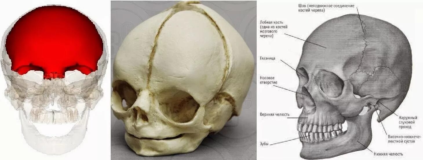 Лобная кость черепа аномалии. Лобные кости черепа выпирают. Выступы на черепе. В правом черепе
