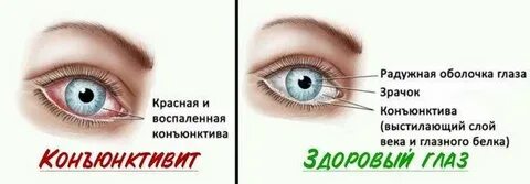 Глаз собирается