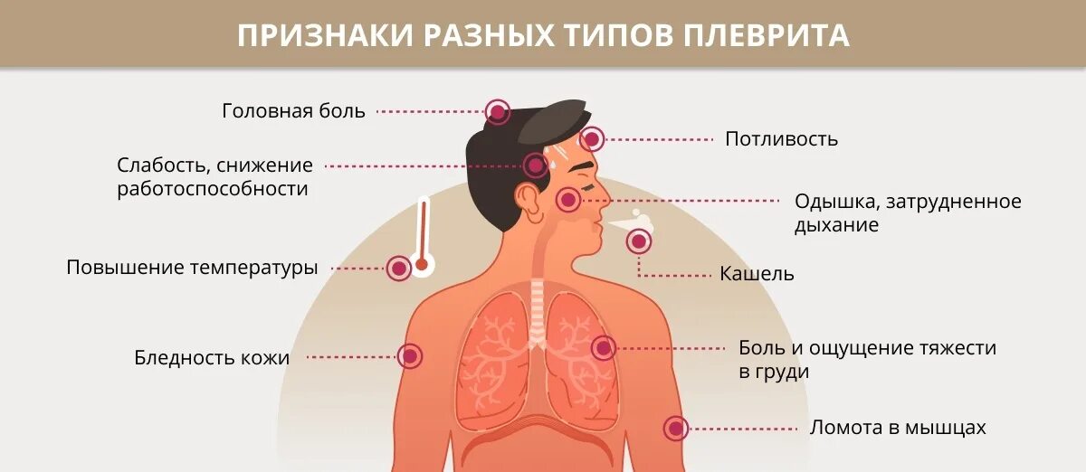 Что может. Патогенез туберкулезного плеврита. Плеврит симптомы.