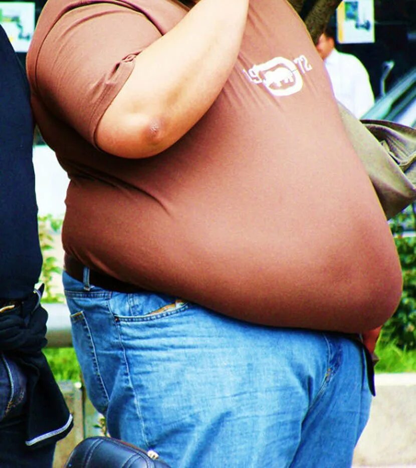 Очень жирный человек