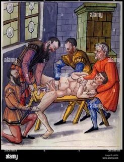 Surgery of hernia in 16th century Stock Photo. 