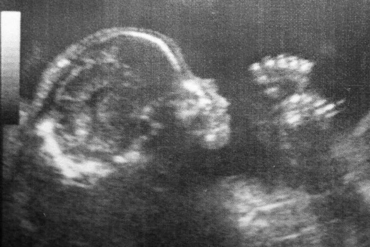 Беременность 34 недели родился. УЗИ плода на 34 неделе беременности. УЗИ ребенка на 34 неделе беременности. Фото 34 недели беременности УЗИ плода. УЗИ снимок ребенка на 34 неделе беременности.
