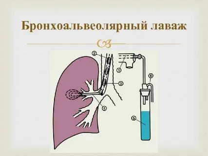 Лаваж