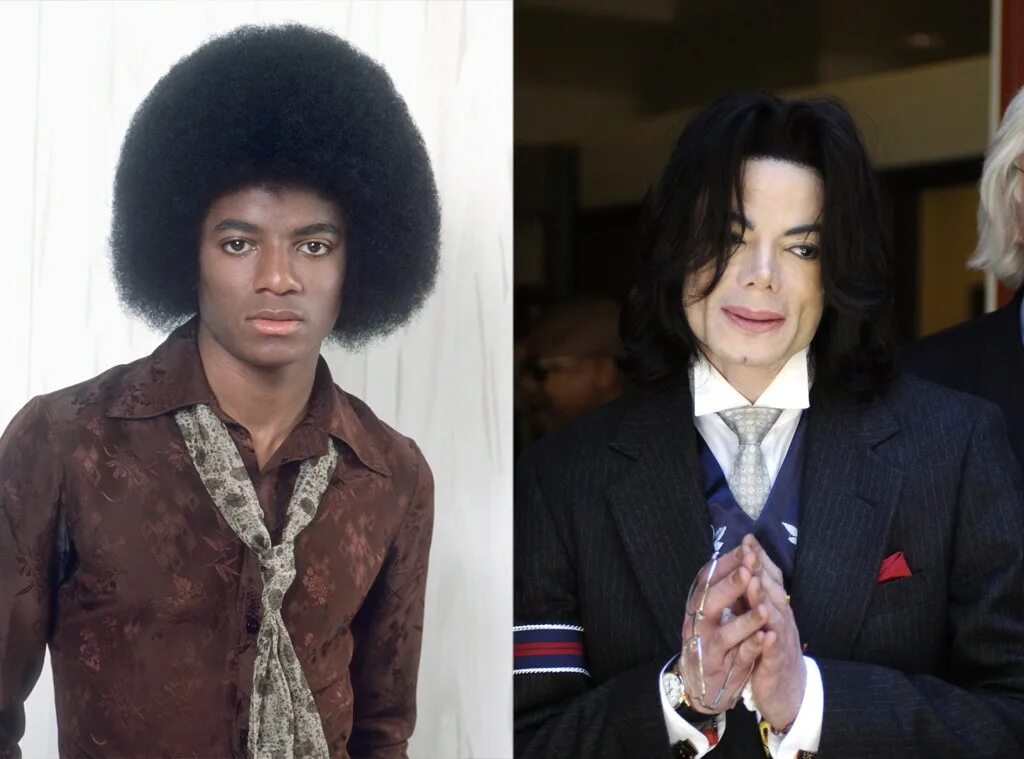 Джексон после операции. Майк лжексон до пластики. Майли джексон до пластики. Джексон после операции. Джексон после операции.