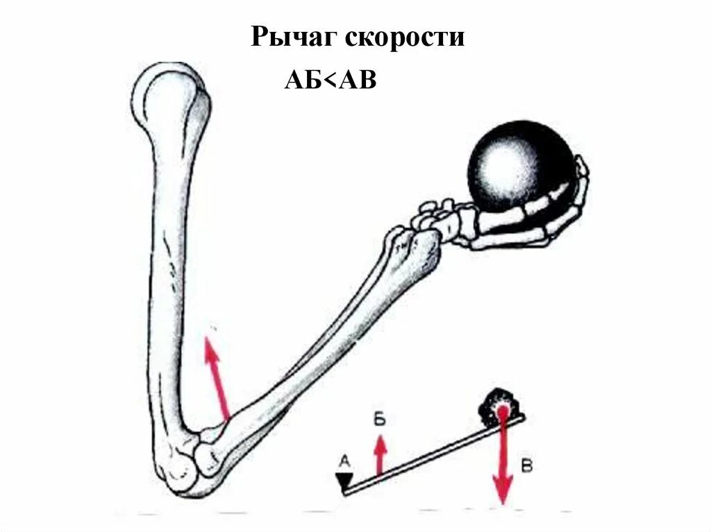 2 рычаг в скелете человека. Рычаги первого и второго рода в биомеханике. Рычаг 2 рода в биомеханике. Рычаг 1 рода в биомеханике. Рычаг 2 рода анатомия.