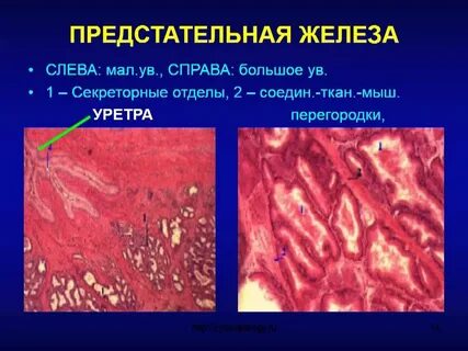 Клетки предстательной железы