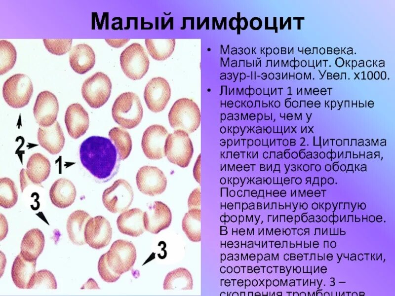 Цитоплазма эритроцитов человека. Мазок крови человека окраска Азур 2 эозином. Кровь человека. Мазок крови. Окраска - Азур-эозин.. Окраска Азур-эозином эритроциты. Мазок крови окраска эозином.