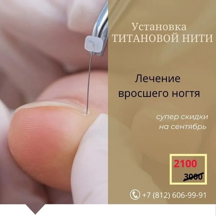 Титановая нить для ногтей. Титановая нить для ногтей