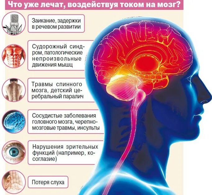 Нарушения головного мозга при гиперактивности. Минимальная мозговая дисфункция причины. Функциональные нарушения головного мозга. Активность мозга. Симптомы нарушения высших мозговых функций.
