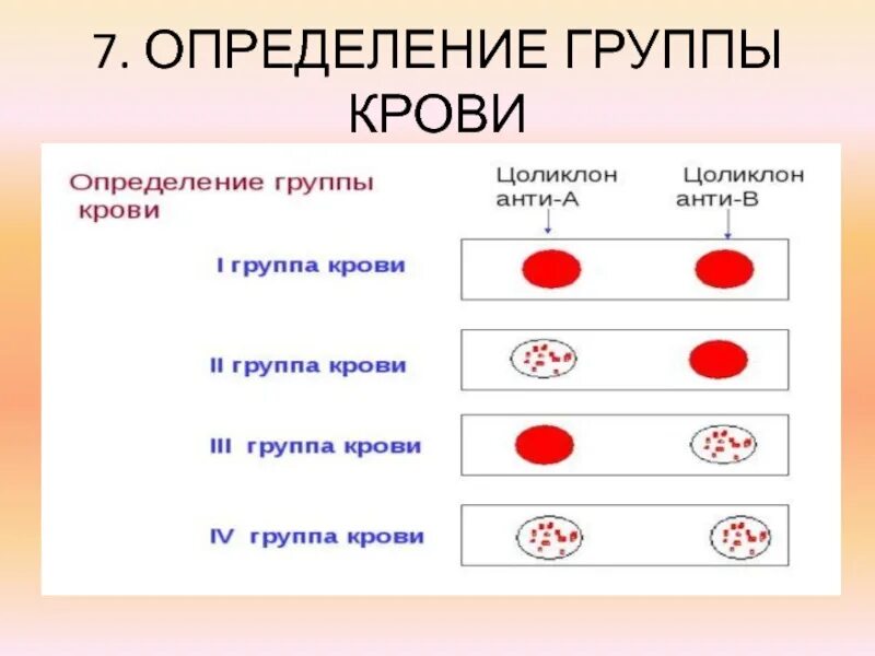 Определение группыкроат. Определение группы крови. Группы крови физиология. Группа крови. Как определить группу предложения