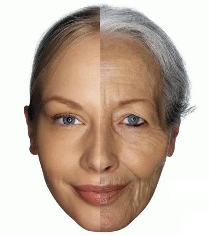 Лица по возрасту. Возрастные изменения лица. Морщины на лице. Возрастные морщины. Возрастные изменения кожи лица.
