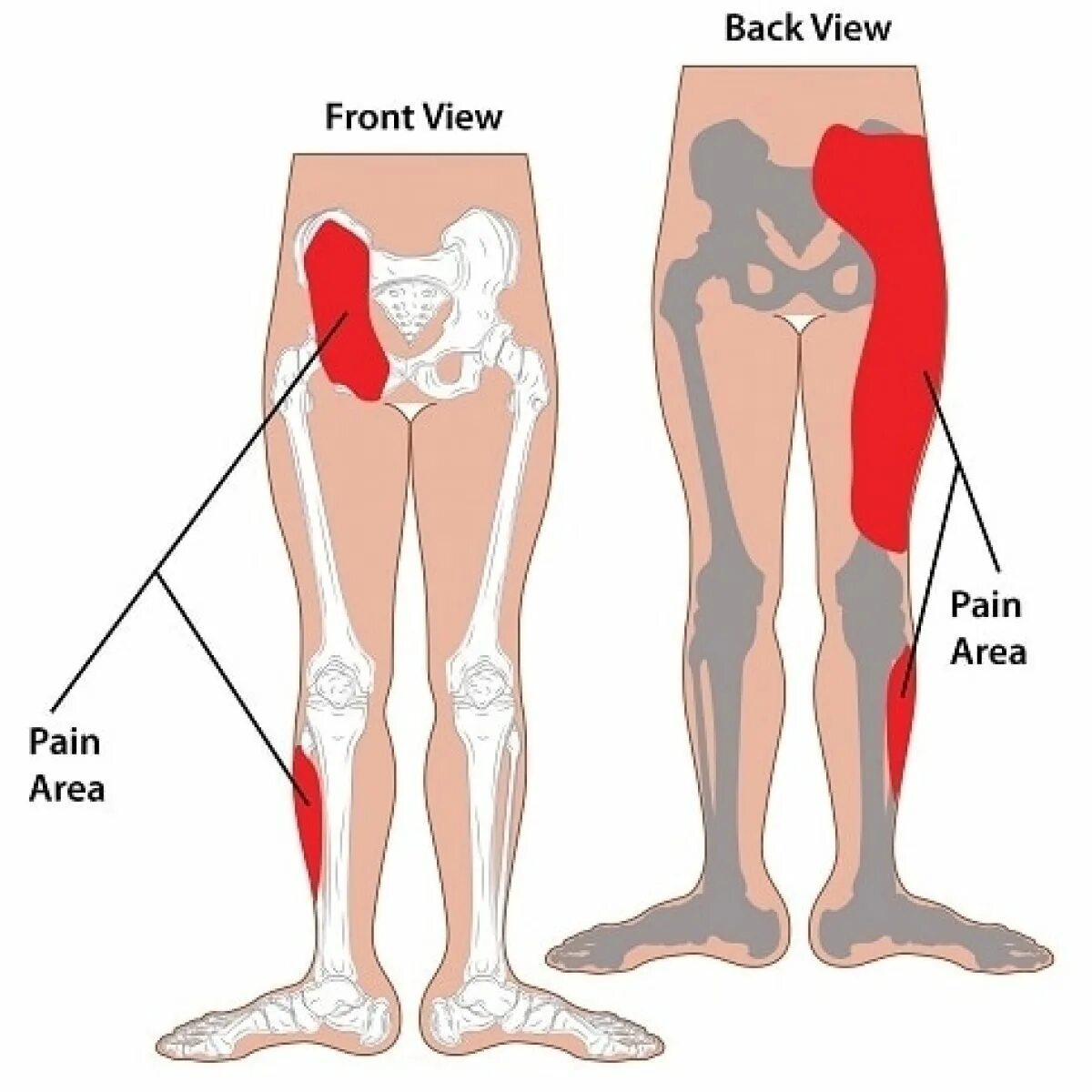 Leg store. Leg joint.