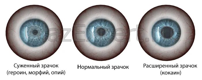 Узкре зрачаи. От наркотиков зрачки сужаются. Нормальный зрачок и расширенный.