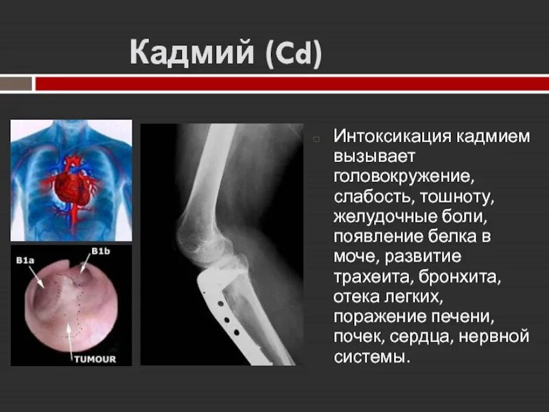 Влияние кадмия на организм человека. Кадмий действие на организм человека.