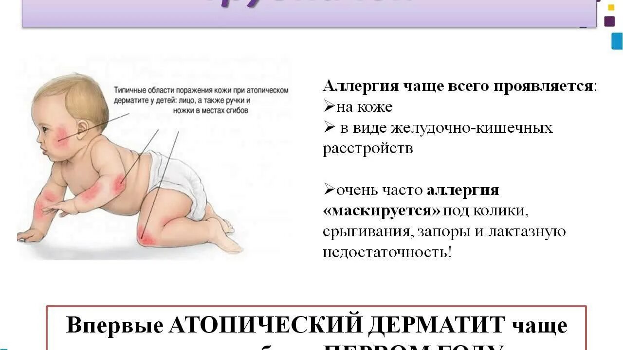 Как проявляется у детей симптомы
